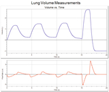 Das Bild zeigt zwei Diagramme zur Messung des Lungenvolumens und der Atemflussrate über die Zeit. Das obere Diagramm stellt das Luftvolumen in Litern dar, während das untere die Flussrate in Litern pro Sekunde anzeigt.